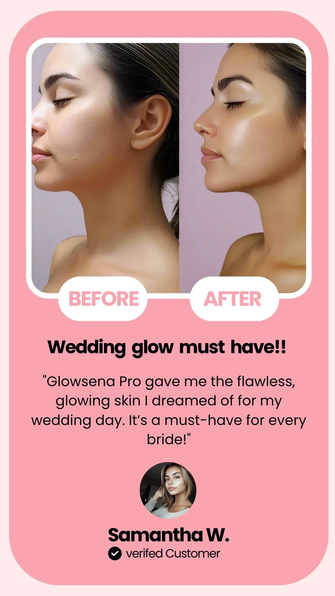Before and after skin comparison with text about wedding glow and product recommendation.

