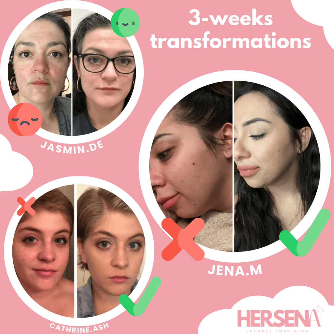 GlowSena Pro - Anti - Aging Device - HerSena