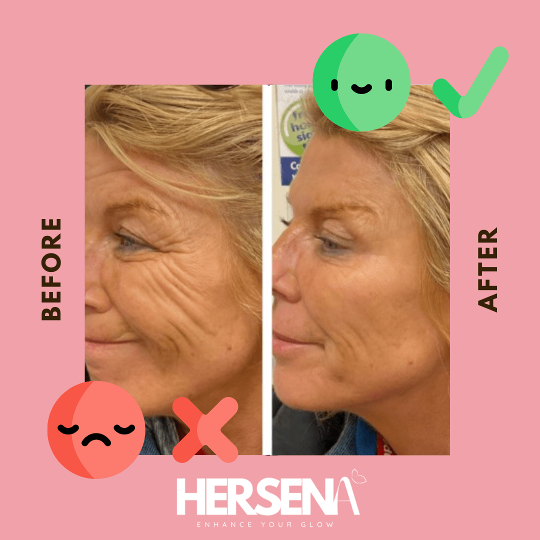 GlowSena Pro - Anti - Aging Device - HerSena