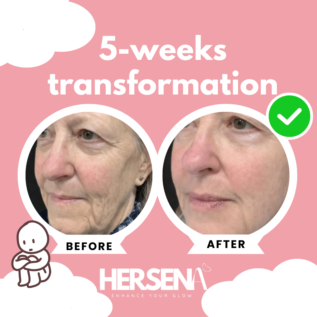 GlowSena Pro - Anti - Aging Device - HerSena