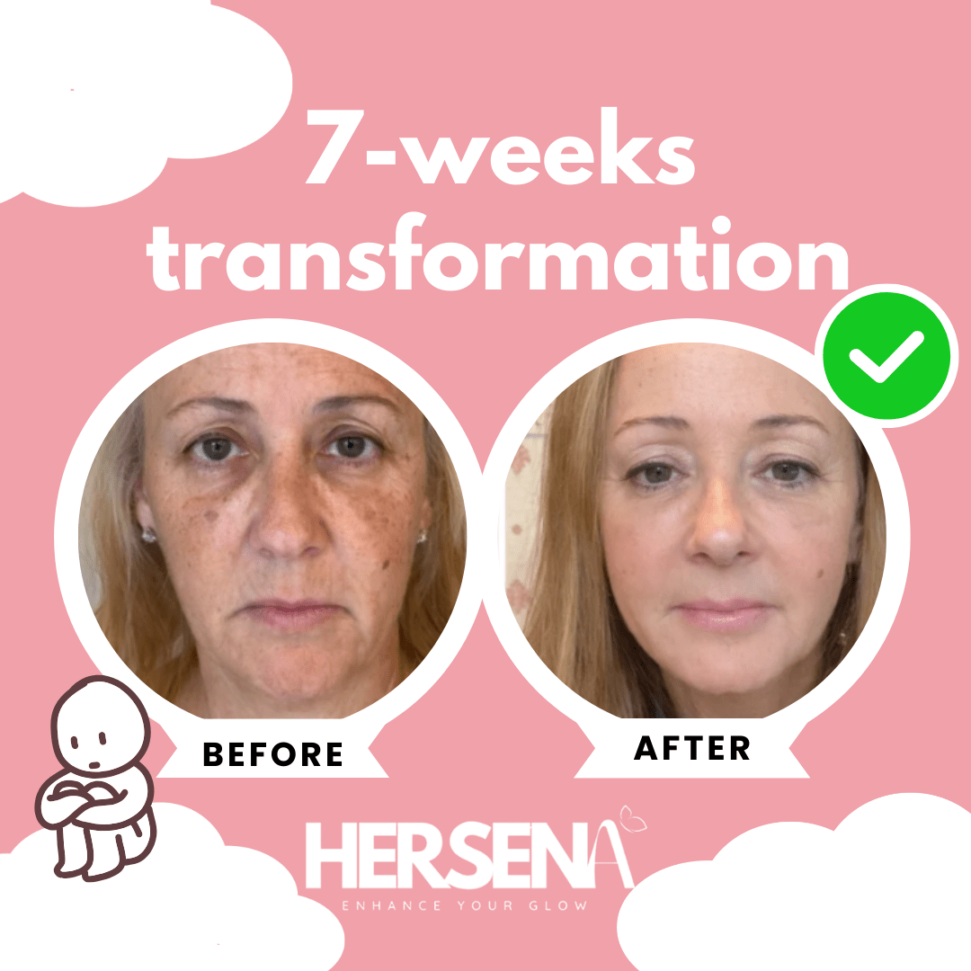 GlowSena Pro - Anti - Aging Device - HerSena