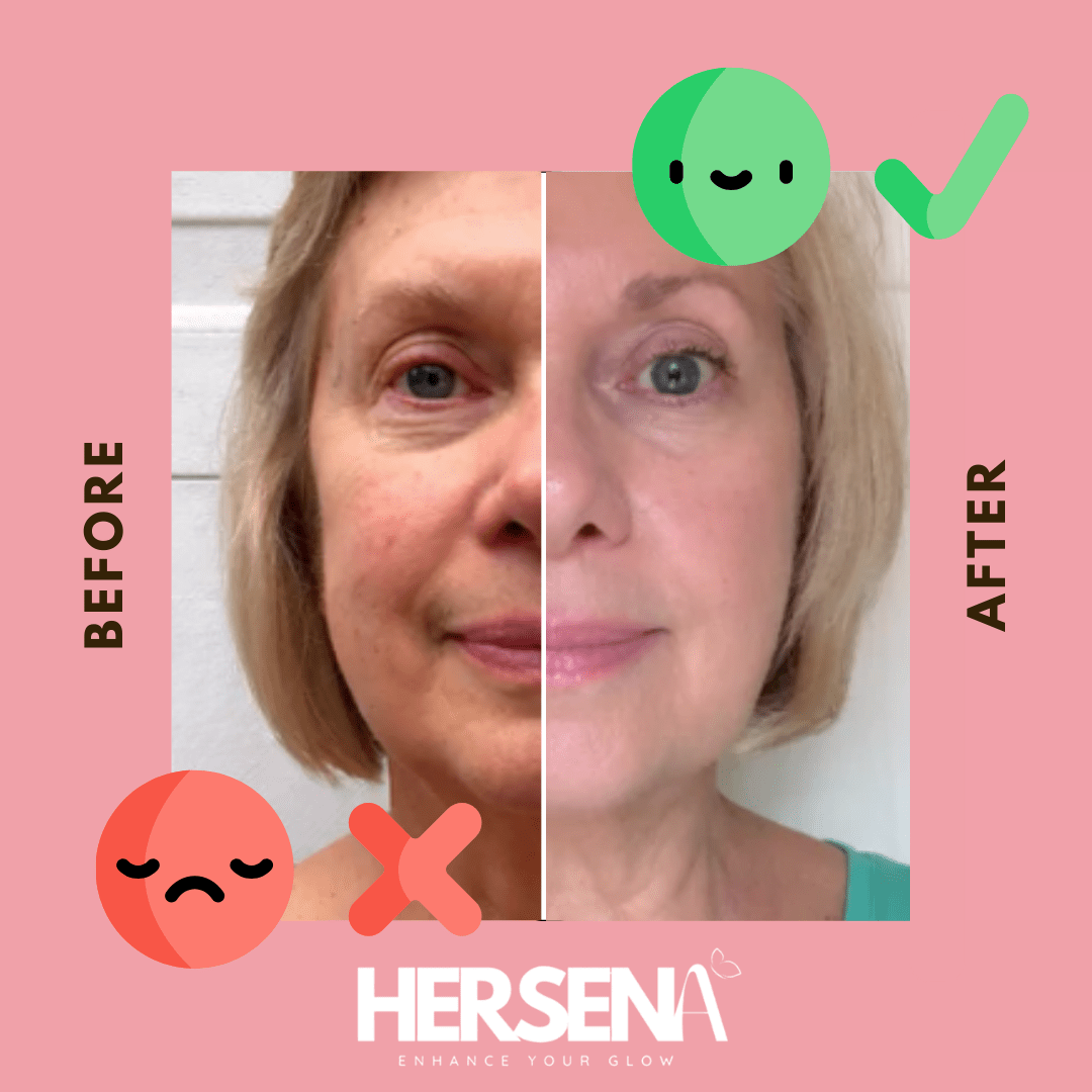 GlowSena Pro - Anti - Aging Device - HerSena