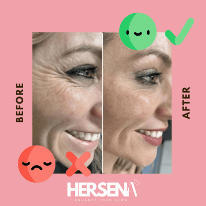 GlowSena Pro - Anti - Aging Device - HerSena