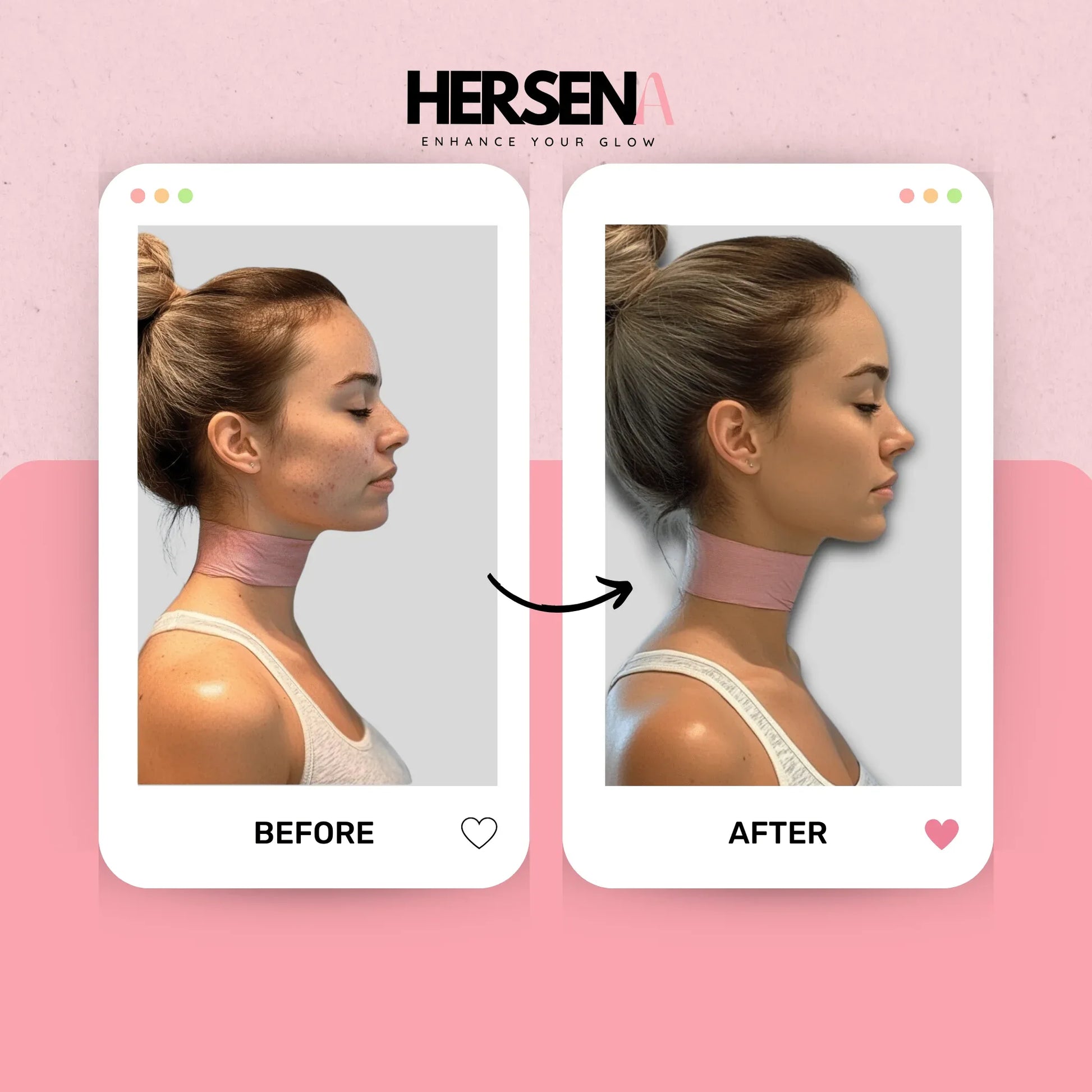 GlowSena Pro - Anti - Aging Device - HerSena
