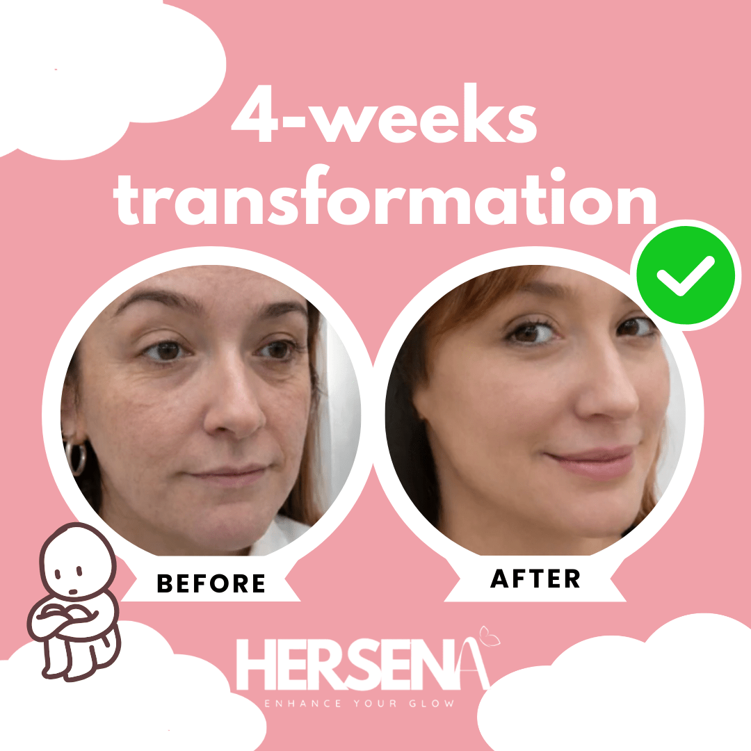 GlowSena Pro - Anti - Aging Device - HerSena