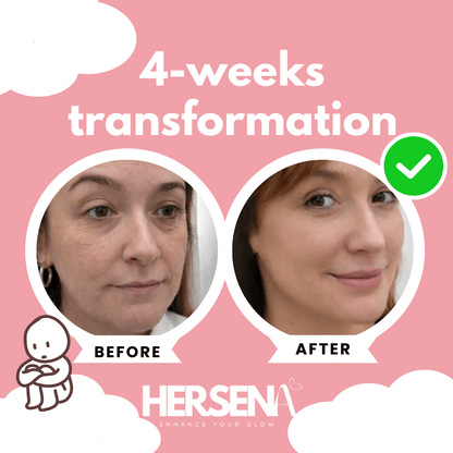 GlowSena Pro - Anti - Aging Device - HerSena